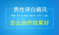 北京白癜风医生：解析男性有白癜风怎么办